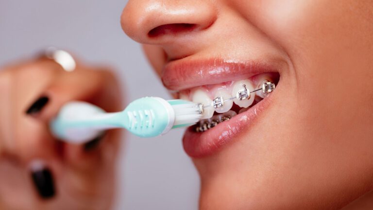 Best Electric Toothbrushes for Braces