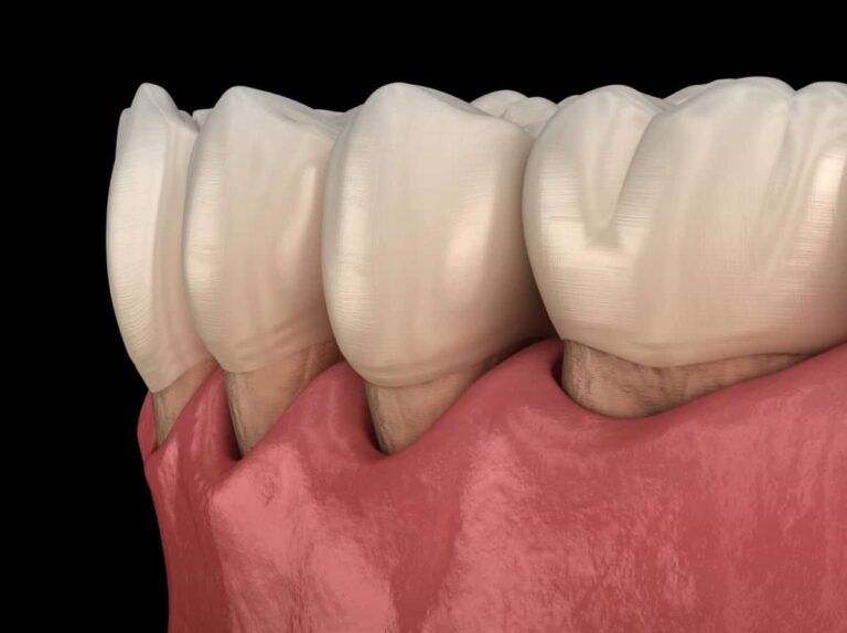 Can an Electric Toothbrush Damage Your Gums? The Truth You Need to Know